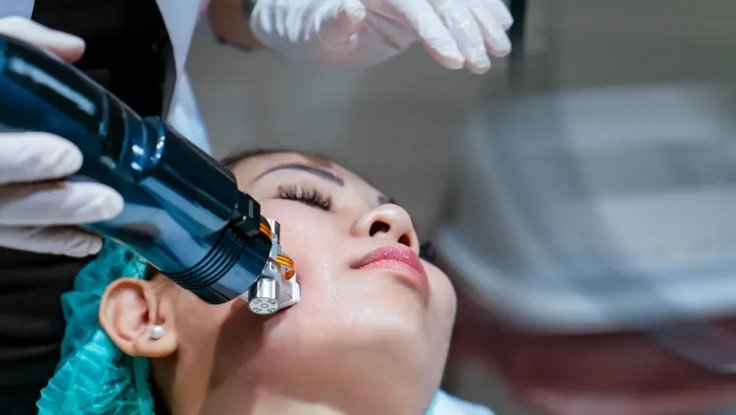 Acne Scar Treatment in Multan treatment at Le Pearl Aesthetic Clinic