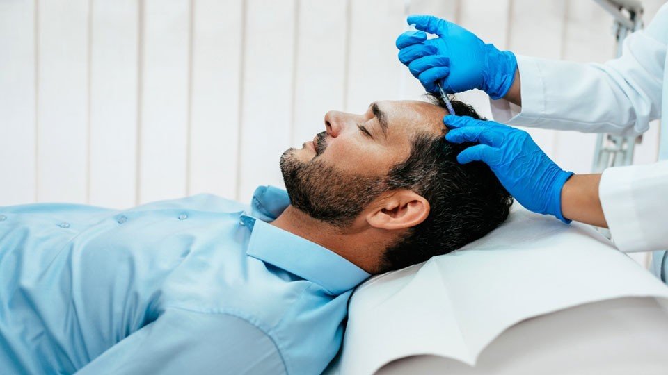 PRP Hair Treatment in Multan for Selected Thinning treatment at Le Pearl Aesthetic Clinic