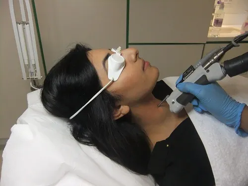 Laser Hair Removal in Multan for Long-Term Reduction treatment at Le Pearl Aesthetic Clinic