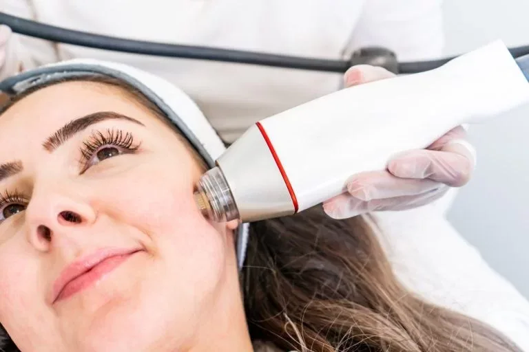 RF microneedling handpiece applied to facial skin for tightening and scar treatment