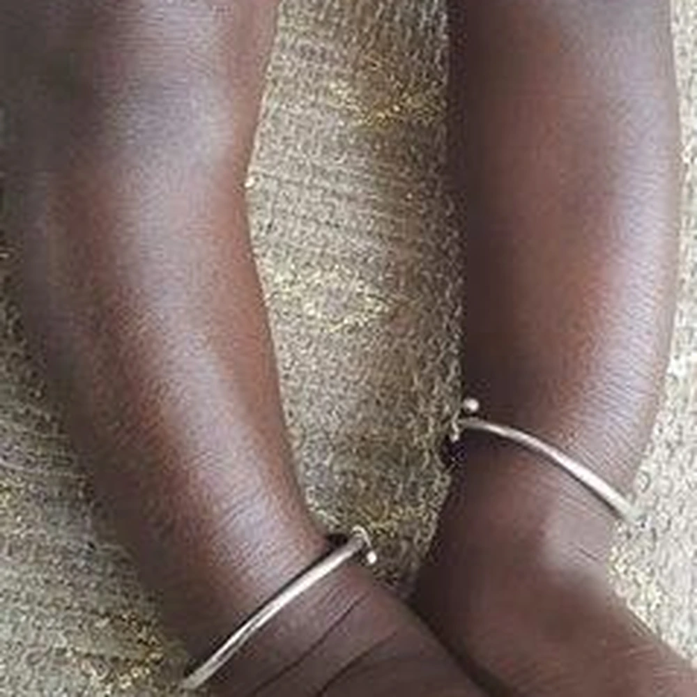 After Eczema Treatment