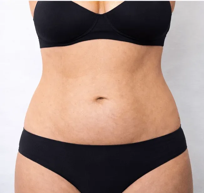 Slimming Injections in Multan for Localised Fat and Weight Reduction after treatment