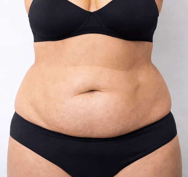 Slimming Injections in Multan for Localised Fat and Weight Reduction before treatment