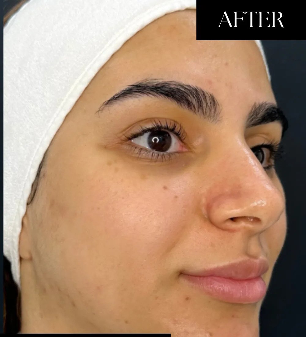 After NAD+ IV Therapy