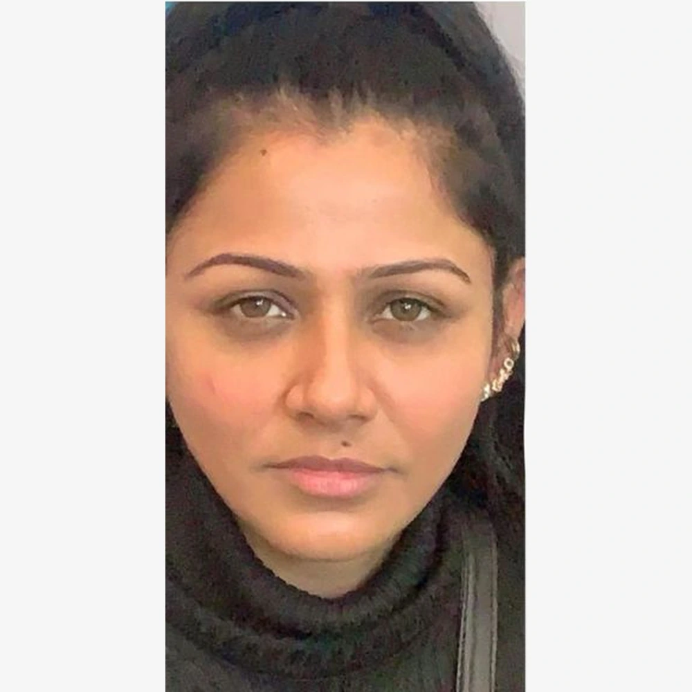 Before Skin Rejuvenation