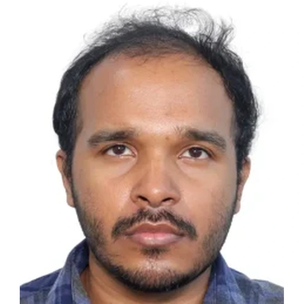 Before Hair Transplant | FUE, Cost and Candidacy