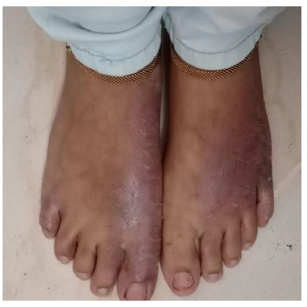 After Skin Allergy Treatment