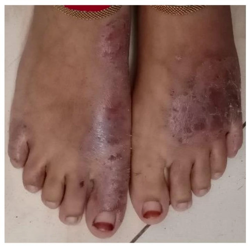 Before Skin Allergy Treatment