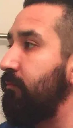 After Beard Treatment