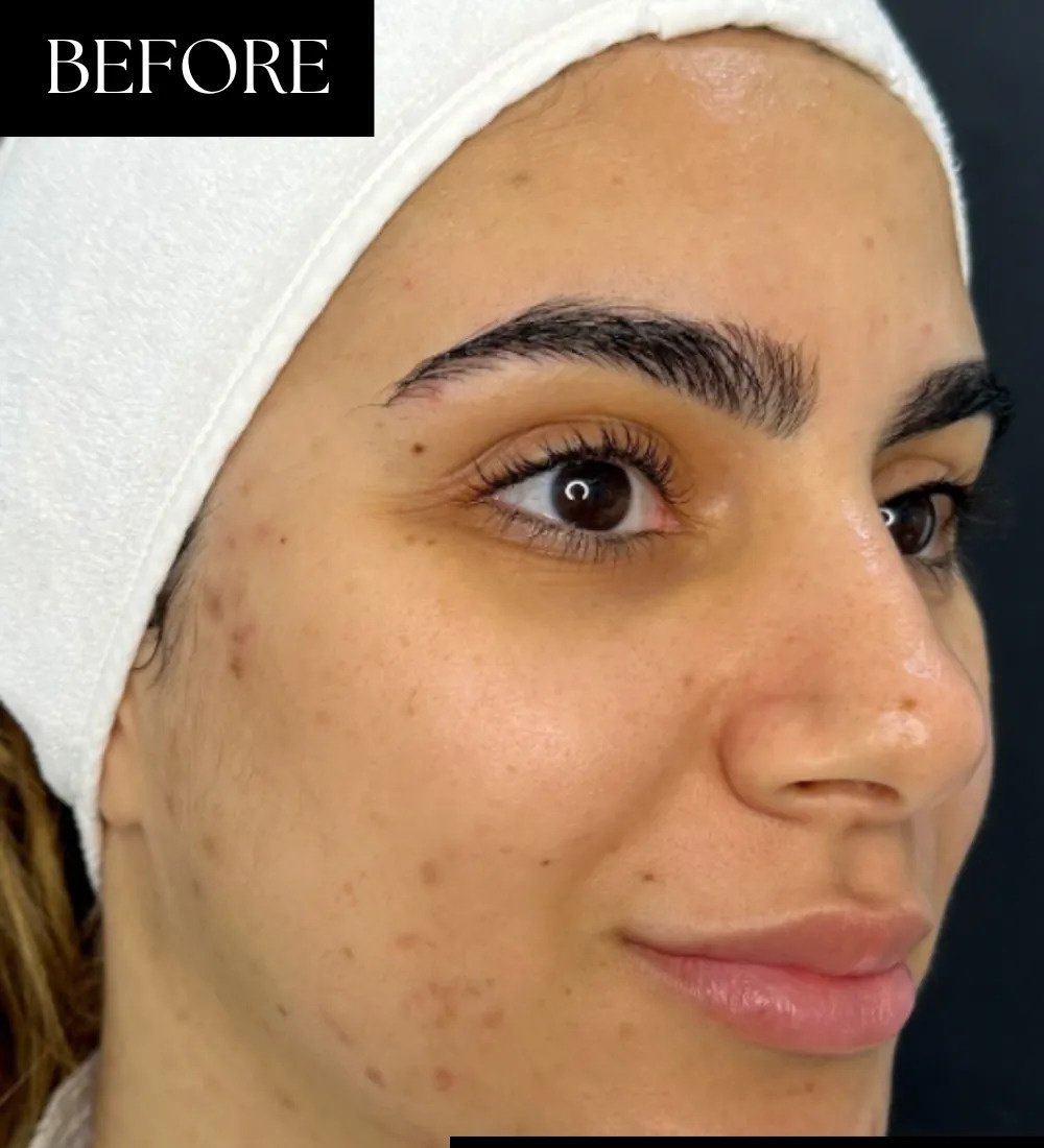 Before NAD+ IV Therapy
