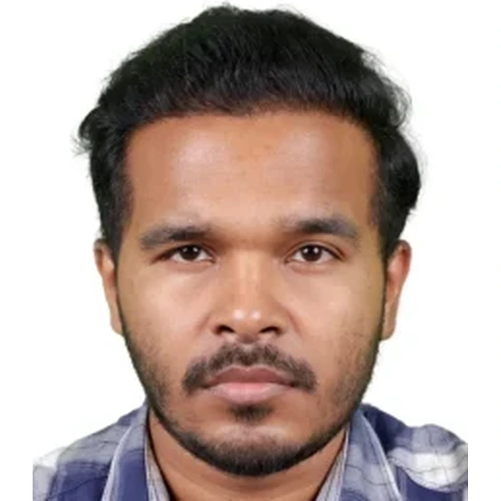 After Hair Transplant | FUE, Cost and Candidacy
