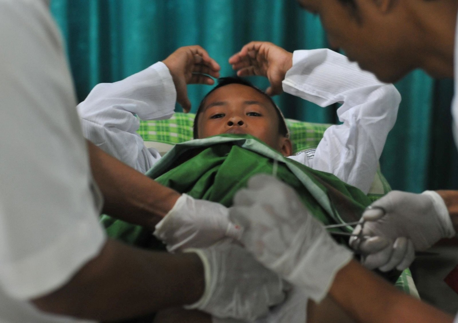 Circumcision in Multan for Newborns, Children and Adults treatment at Le Pearl Aesthetic Clinic