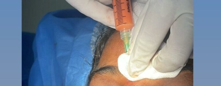 Fat Grafting in Multan: Face, Hands, Scars, Breast, Penis treatment at Le Pearl Aesthetic Clinic