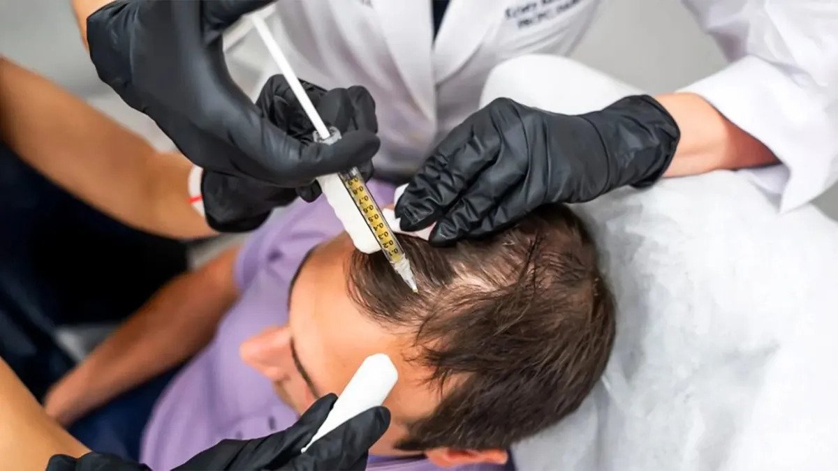 PRGF Hair and Skin Treatment in Multan treatment at Le Pearl Aesthetic Clinic