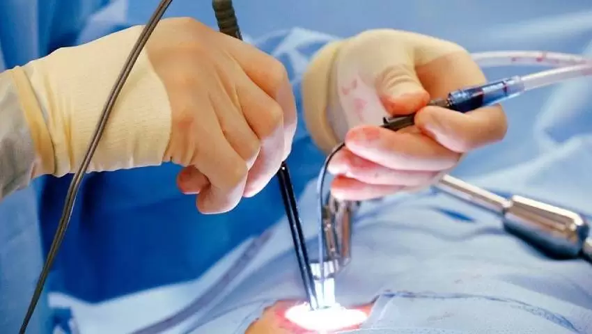 Laser Proctology